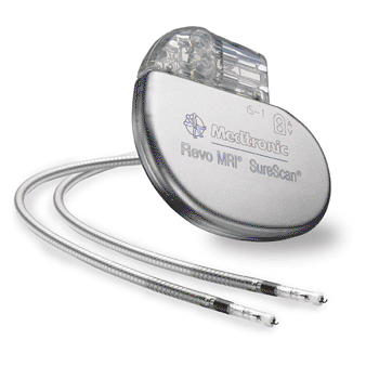 Image: The SureScan line of neurostimulation systems for the treatment of chronic pain are designed for compatibility with full-body MRI scans (Photo courtesy of Medtronic).